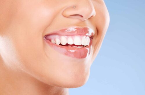 bright white smile against a sky blue background, teeth whitening, veneers