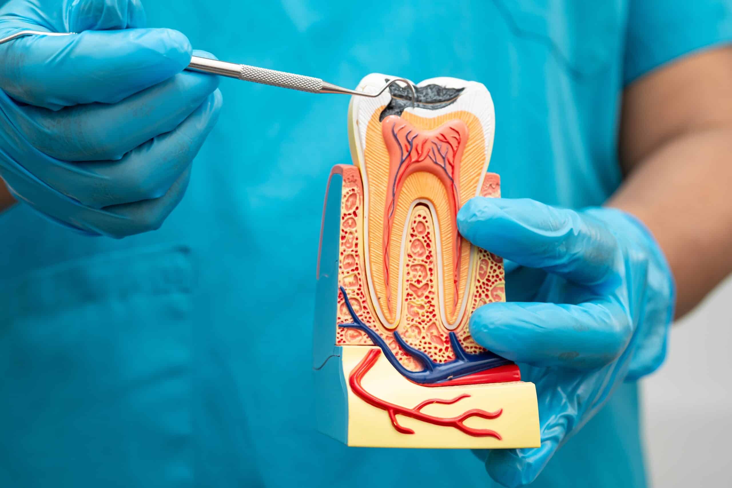 dentist holding dental implant, artificial tooth roots into jaw, root canal of dental treatment