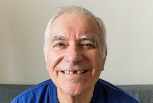 older man smiling, showing the gaps in his smile