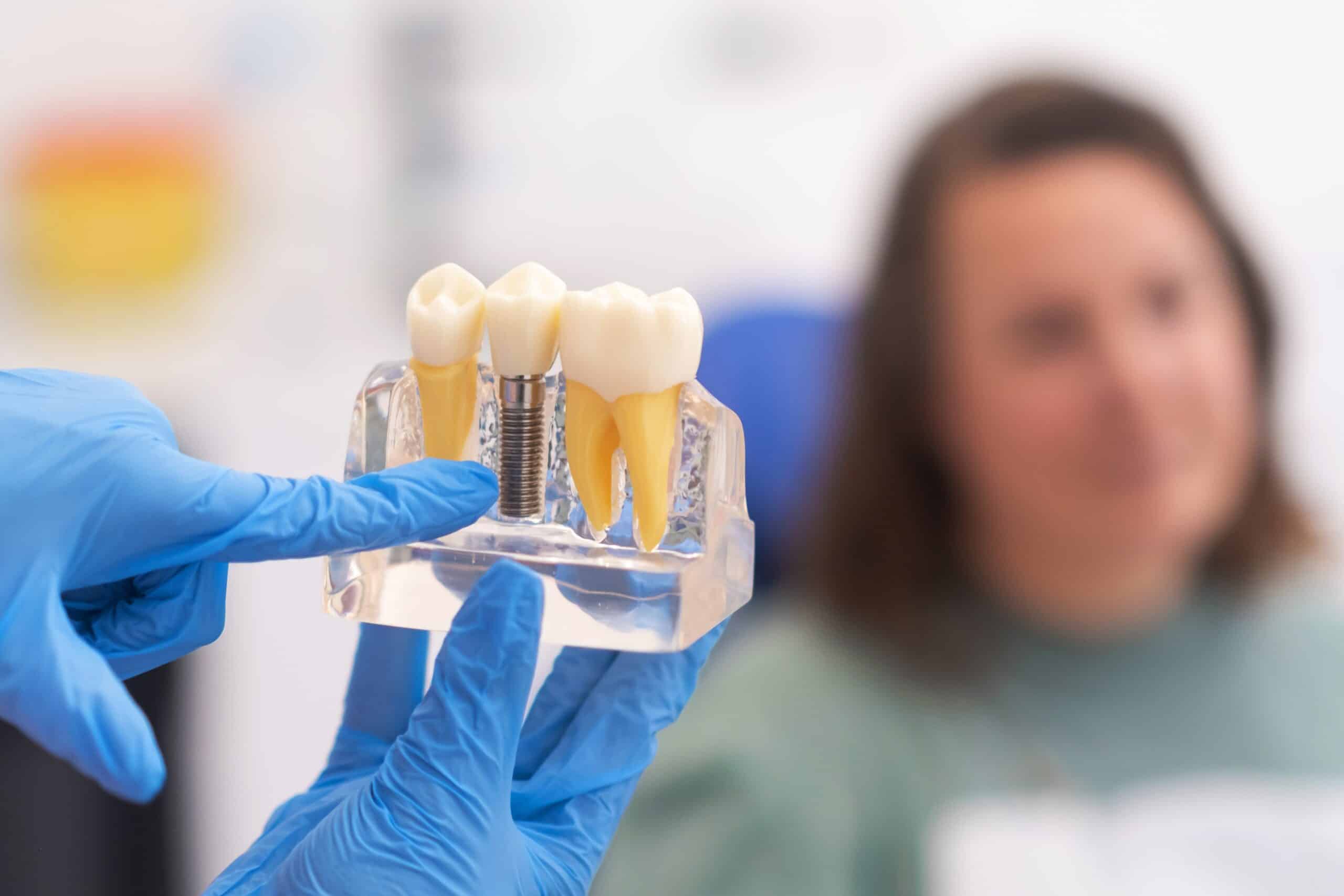 dentist in blue gloves showing an implant model to a female patient